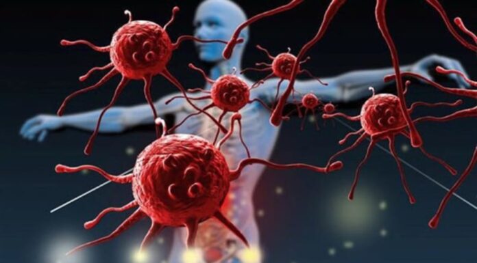 The Man Who Never Did This for 30 Years: A Shocking Admission After Being Diagnosed With Cancer and 3 Malignant Tumors