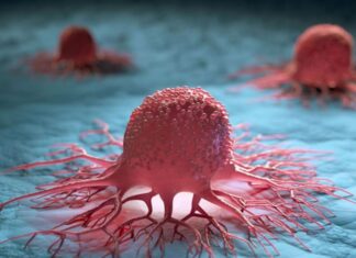 Does Cancer Run in Families? Tips to Halt the Growth of Cancerous Cells.