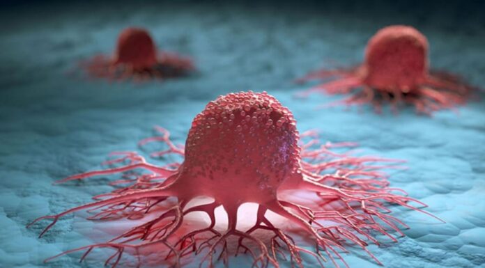Does Cancer Run in Families? Tips to Halt the Growth of Cancerous Cells.