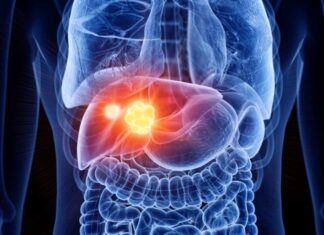 9 Early Warning Signs of Liver Cancer That Should Not Be Ignored