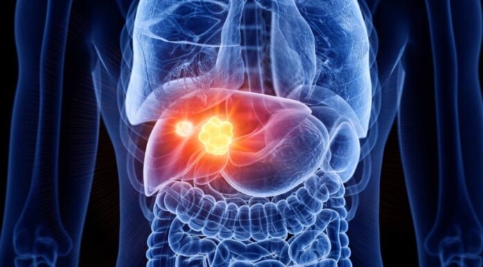 9 Early Warning Signs of Liver Cancer That Should Not Be Ignored