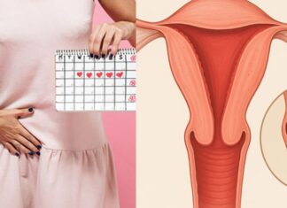 10 Early Warning Signs of Cervical Cancer: Are You Ignoring #2?