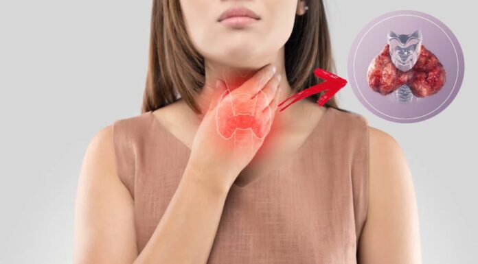 Thyroid Cancer: The Silent Threat – 6 Groups at Risk Need to Be Vigilant
