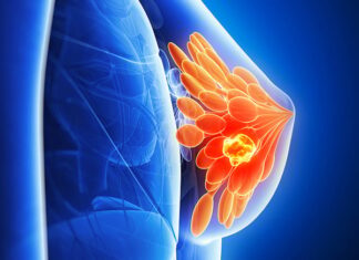 Two Terrible Habits of Husbands That Increase Their Wives’ Risk of Breast Cancer: Stop Now for Your Family’s Sake!