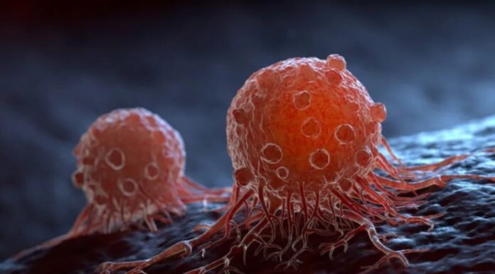 3 Morning Symptoms That Could Be Warning Signs of Cancer: Don’t Ignore These Red Flags