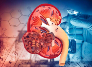 From a 22-year-old’s End-Stage Renal Disease: A Warning Sign from the Body’s Whispers