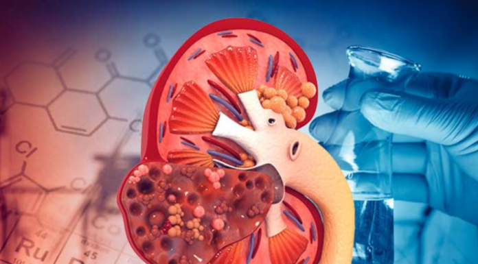 From a 22-year-old’s End-Stage Renal Disease: A Warning Sign from the Body’s Whispers