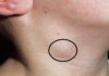 3 Unusual Signs at the Neck: A Warning for an Impending Health Disaster