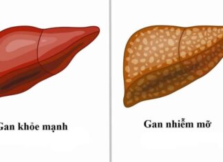 Does Fatty Liver Cause Liver Cancer? Expert Reveals Signs You Need to Know.