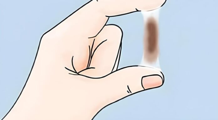 Post-Coital Bleeding: Ignoring Cervical Cancer Symptoms Could Prove Fatal