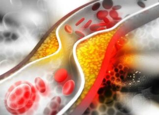 Is Eating Egg Yolks Really a Cause for Cholesterol Overload? The Surprising Truth Unveiled.