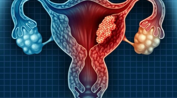 3 Bedroom Habits of Your Husband that May Increase Your Risk of Cervical Cancer: Stop Them Now!