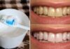 Teeth Whitening: Brush with This to Remove Stains and Plaque Without Enamel Erosion.