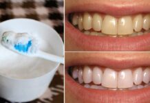 Teeth Whitening: Brush with This to Remove Stains and Plaque Without Enamel Erosion.