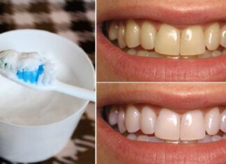 Teeth Whitening: Brush with This to Remove Stains and Plaque Without Enamel Erosion.