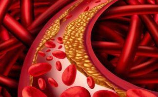 The Skinny on High Cholesterol: Why Slim People Are at Risk Too