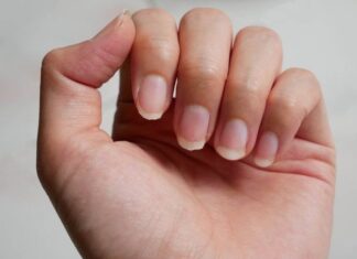 The Secrets Your Nails Can Tell About Your Health.