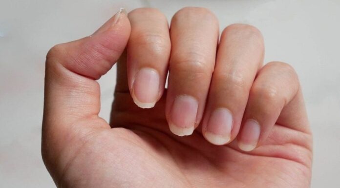 The Secrets Your Nails Can Tell About Your Health.