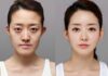 Does Plastic Surgery Affect Your Fate According to Physiognomy?