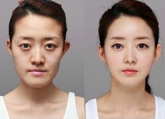 Does Plastic Surgery Affect Your Fate According to Physiognomy?