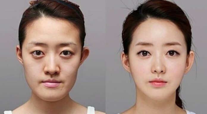Does Plastic Surgery Affect Your Fate According to Physiognomy?
