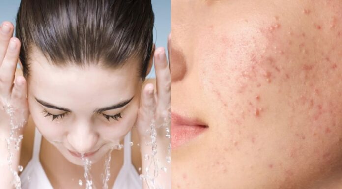 5 Daily Habits That Are Sabotaging Your Pores