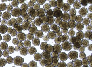 Great News: Diabetics Have Hope for Restoring Insulin Production