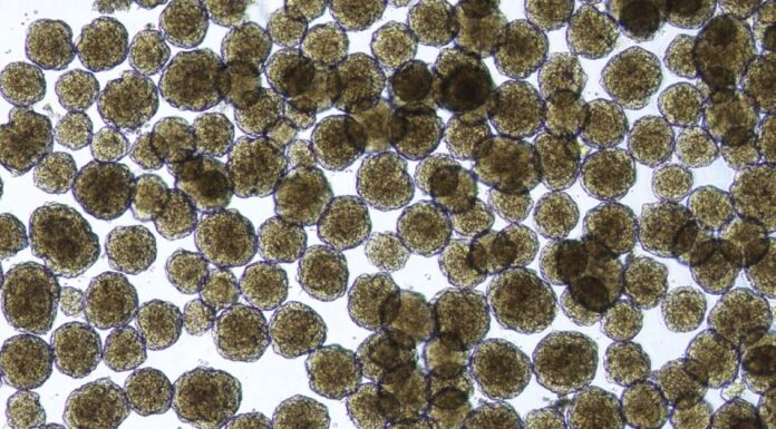 Great News: Diabetics Have Hope for Restoring Insulin Production