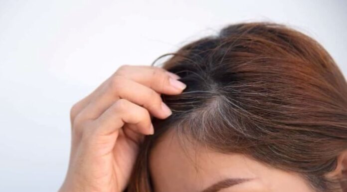 3 Essential Nutrients to Prevent Premature Greying