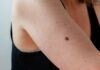 Warning: Tiny Spots on Your Skin Could Be a Sign of Cancer – Stay Vigilant