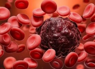 Early Cancer Detection: Revolutionizing Cancer Screening with a Simple Blood Test