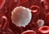 7 Warning Signs of Leukemia You Shouldn’t Ignore