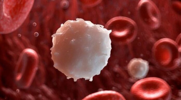 7 Warning Signs of Leukemia You Shouldn’t Ignore