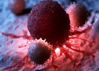 6 Painful Spots on Your Body That Could Be Early Cancer Warning Signs: Don’t Ignore, Act Now!