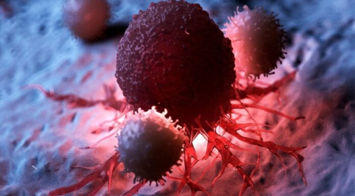 6 Painful Spots on Your Body That Could Be Early Cancer Warning Signs: Don’t Ignore, Act Now!