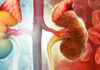 8 Warning Signs of Early-Stage Kidney Disease: Ignoring These May Lead to a Lifetime of Dialysis