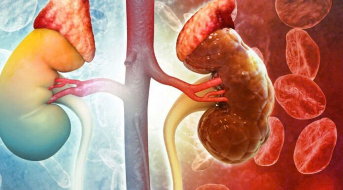 8 Warning Signs of Early-Stage Kidney Disease: Ignoring These May Lead to a Lifetime of Dialysis