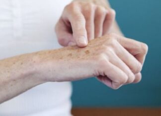 The Secret to Flawless Hands: A Guide to Fading Age Spots and Rejuvenating Your Skin