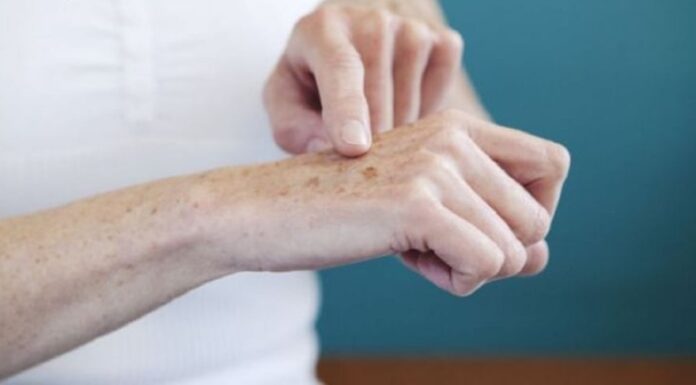 The Secret to Flawless Hands: A Guide to Fading Age Spots and Rejuvenating Your Skin