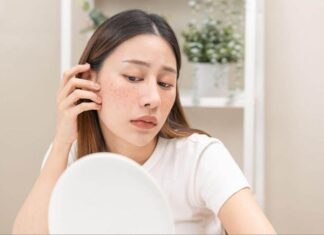 6 Common Habits That Are Worsening Your Skin Pigmentation Issues