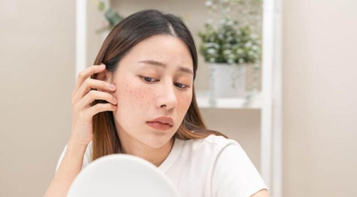 6 Common Habits That Are Worsening Your Skin Pigmentation Issues