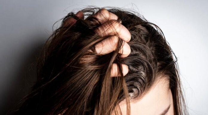 “Should Oily Hair Be Washed Daily?”