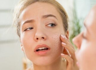 What’s Keeping Your Acne-Prone Skin Dry and Breaking Out?