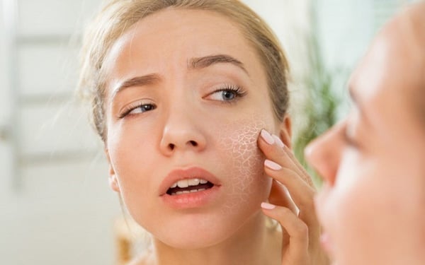 What’s Keeping Your Acne-Prone Skin Dry and Breaking Out?