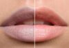 “The Ultimate Guide to Naturally Lighten Dark Lips at Home”