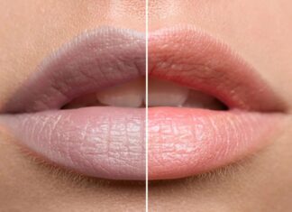 “The Ultimate Guide to Naturally Lighten Dark Lips at Home”