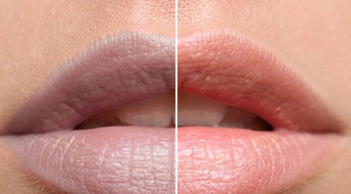 “The Ultimate Guide to Naturally Lighten Dark Lips at Home”