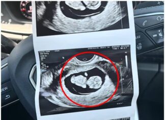 20-Week Ultrasound Shock: Young Mom Stunned by Doctor’s Unexpected Diagnosis