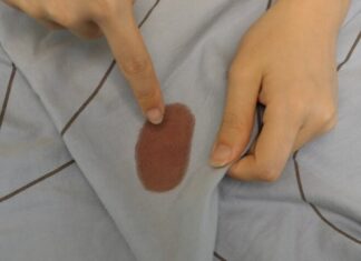 “Washing Blood Stains from Bed Sheets: Why Hot Water and Detergent Are a Big Mistake—Here’s the Right Way to Remove Them Completely”