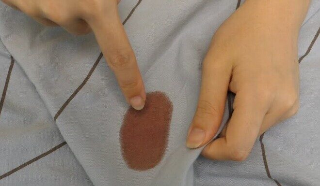 “Washing Blood Stains from Bed Sheets: Why Hot Water and Detergent Are a Big Mistake—Here’s the Right Way to Remove Them Completely”